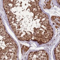 Anti-ZBTB5 antibody produced in rabbit 