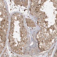 Anti-ZBTB8A antibody produced in rabbit 