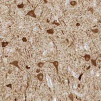 Anti-ZBTB8A antibody produced in rabbit 