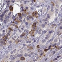 Anti-ZBTB8B antibody produced in rabbit 