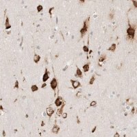 Anti-ZC2HC1A antibody produced in rabbit HPA024726-100UL