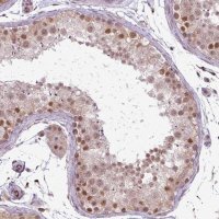 Anti-ZC2HC1C antibody produced in rabbit 