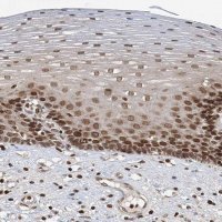 Anti-ZC3H13 antibody produced in rabbit 