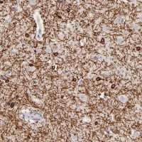 Anti-ZC3H7B antibody produced in rabbit 