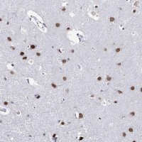 Anti-ZC3H8 antibody produced in rabbit 