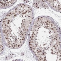 Anti-ZCCHC17 antibody produced in rabbit 