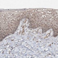 Anti-ZCCHC4 antibody produced in rabbit 