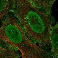 Anti-ZCCHC5 antibody produced in rabbit 