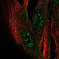Anti-ZCWPW2 antibody produced in rabbit 