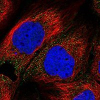 Anti-ZDHHC1 antibody produced in rabbit 