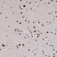 Anti-ZDHHC12 antibody produced in rabbit 