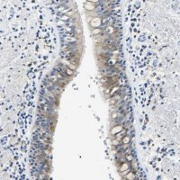 Anti-ZDHHC13 antibody produced in rabbit 