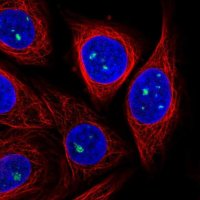 Anti-ZDHHC14 antibody produced in rabbit 