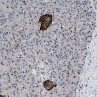 Anti-ZDHHC15 antibody produced in rabbit 