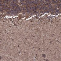 Anti-ZDHHC21 antibody produced in rabbit 