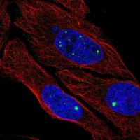 Anti-ZDHHC4 antibody produced in rabbit 