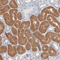 Anti-ZDHHC8 antibody produced in rabbit