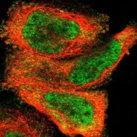 Anti-ZDHHC8 antibody produced in rabbit