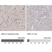 Anti-ZEB1 antibody produced in rabbit 