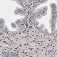 Anti-ZEB1 antibody produced in rabbit 