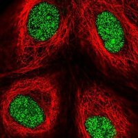 Anti-ZFP69 antibody produced in rabbit 
