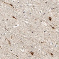 Anti-ZFPM2 antibody produced in rabbit 