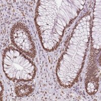 Anti-ZFR2 antibody produced in rabbit 