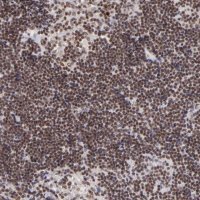 Anti-ZFX antibody produced in rabbit 