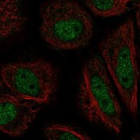 Anti-ZFY antibody produced in rabbit 