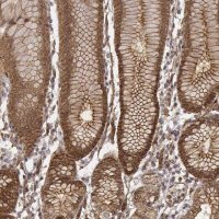 Anti-ZFYVE19 antibody produced in rabbit 