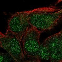 Anti-ZFYVE27 antibody produced in rabbit HPA069876-100UL