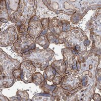 Anti-ZFYVE28 antibody produced in rabbit 