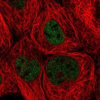 Anti-ZHX3 antibody produced in rabbit 