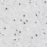 Anti-ZIC1 antibody produced in rabbit 