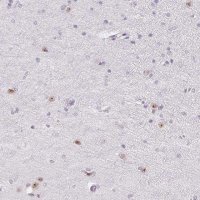 Anti-ZIC4 antibody produced in rabbit 
