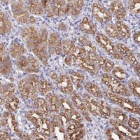 Anti-ZIK1 antibody produced in rabbit