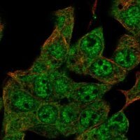 Anti-ZIM2 antibody produced in rabbit 