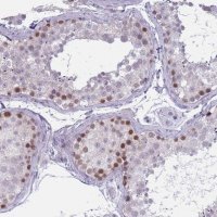 Anti-ZKSCAN2 antibody produced in rabbit 