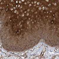 Anti-ZKSCAN5 antibody produced in rabbit 