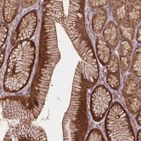Anti-ZMYND19 antibody produced in rabbit 