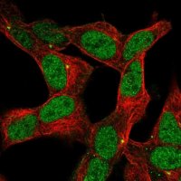 Anti-ZNF12 antibody produced in rabbit 