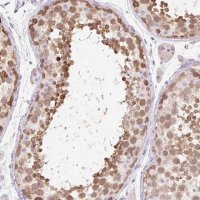 Anti-ZNF121 antibody produced in rabbit 