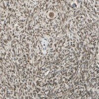 Anti-ZNF135 antibody produced in rabbit 