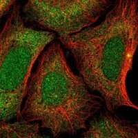 Anti-ZNF14 antibody produced in rabbit 