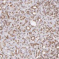 ANTI-ZNF148 antibody produced in rabbit 