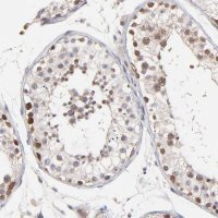 Anti-ZNF177 antibody produced in rabbit 