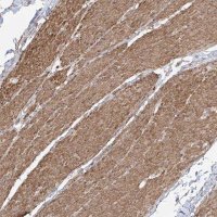 Anti-ZNF180 antibody produced in rabbit 