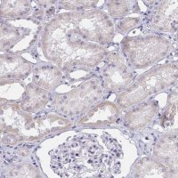 Anti-ZNF182 antibody produced in rabbit 