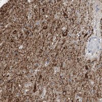 Anti-ZNF189 antibody produced in rabbit 