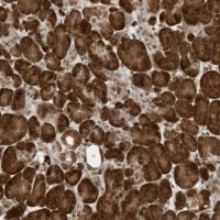 Anti-ZNF195 antibody produced in rabbit 
